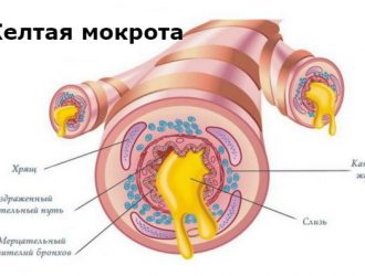 Образование желтой мокроты — патологическое состояние