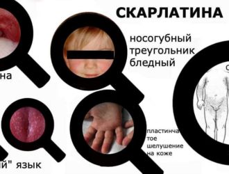 Скарлатина у Детей